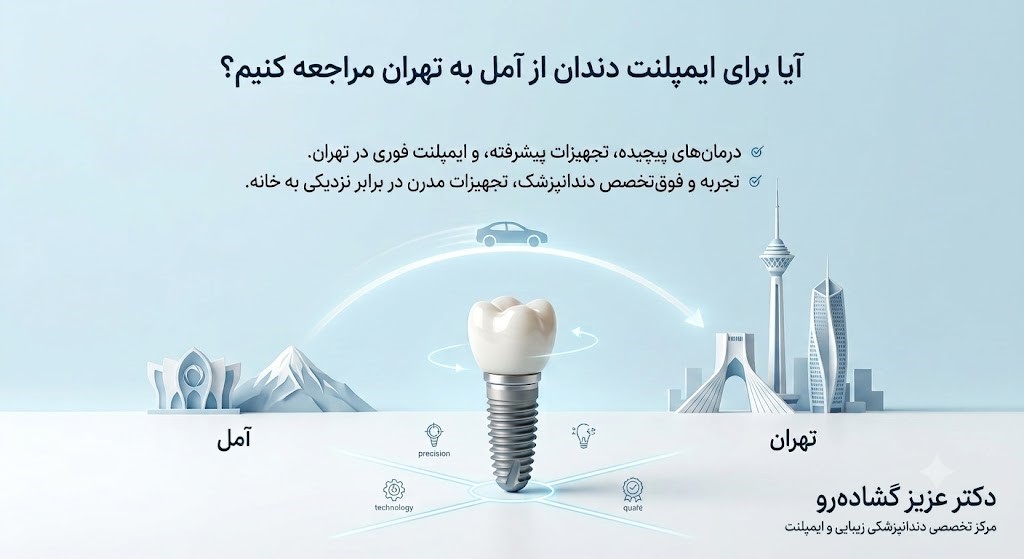 برای ایمپلنت دندان از آمل به تهران مراجعه کنیم؟